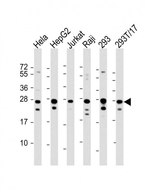 PCMT1 Antibody - All lanes: Anti-PCMT1 Antibody (Center) at 1:2000 dilution Lane 1: Hela whole cell lysate Lane 2: HepG2 whole cell lysate Lane 3: Jurkat whole cell lysate Lane 4: Raji whole cell lysate Lane 5: 293 whole cell lysate Lane 6: 293T/17 whole cell lysate Lysates/proteins at 20 µg per lane. Secondary Goat Anti-Rabbit IgG, (H+L), Peroxidase conjugated at 1/10000 dilution. Predicted band size: 25 kDa Blocking/Dilution buffer: 5% NFDM/TBST.
