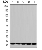 PCMT1 Antibody - Western blot analysis of PCMT1 expression in HepG2 (A); A431 (B); mouse liver (C); rat brain (D); rat heart (E) whole cell lysates.