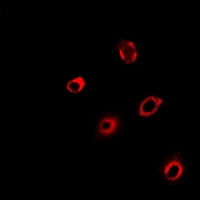 PCMT1 Antibody - Immunofluorescent analysis of PCMT1 staining in HeLa cells. Formalin-fixed cells were permeabilized with 0.1% Triton X-100 in TBS for 5-10 minutes and blocked with 3% BSA-PBS for 30 minutes at room temperature. Cells were probed with the primary antibody in 3% BSA-PBS and incubated overnight at 4 deg C in a humidified chamber. Cells were washed with PBST and incubated with a DyLight 594-conjugated secondary antibody (red) in PBS at room temperature in the dark.