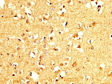 PCMT1 Antibody - Immunohistochemistry image at a dilution of 1:200 and staining in paraffin-embedded human brain tissue performed on a Leica BondTM system. After dewaxing and hydration, antigen retrieval was mediated by high pressure in a citrate buffer (pH 6.0) . Section was blocked with 10% normal goat serum 30min at RT. Then primary antibody (1% BSA) was incubated at 4 °C overnight. The primary is detected by a biotinylated secondary antibody and visualized using an HRP conjugated SP system.