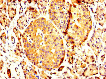 PCMT1 Antibody - Immunohistochemistry image at a dilution of 1:200 and staining in paraffin-embedded human pancreatic tissue performed on a Leica BondTM system. After dewaxing and hydration, antigen retrieval was mediated by high pressure in a citrate buffer (pH 6.0) . Section was blocked with 10% normal goat serum 30min at RT. Then primary antibody (1% BSA) was incubated at 4 °C overnight. The primary is detected by a biotinylated secondary antibody and visualized using an HRP conjugated SP system.