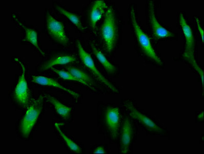 PCMT1 Antibody - Immunofluorescence staining of Hela cells with PCMT1 Antibody at 1:66, counter-stained with DAPI. The cells were fixed in 4% formaldehyde, permeabilized using 0.2% Triton X-100 and blocked in 10% normal Goat Serum. The cells were then incubated with the antibody overnight at 4°C. The secondary antibody was Alexa Fluor 488-congugated AffiniPure Goat Anti-Rabbit IgG(H+L).