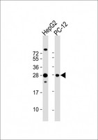 PCMT1 Antibody - All lanes: Anti-PCMT1 Antibody (N-Term) at 1:2000 dilution Lane 1: HepG2 whole cell lysate Lane 2: PC-12 whole cell lysate Lysates/proteins at 20 µg per lane. Secondary Goat Anti-Rabbit IgG, (H+L), Peroxidase conjugated at 1/10000 dilution. Predicted band size: 25 kDa Blocking/Dilution buffer: 5% NFDM/TBST.