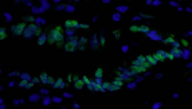 PCNA Antibody - Detection of human PCNA by immunohistochemistry. Sample: FFPE section of human stomach carcinoma. Antibody: Affinity purified rabbit anti-PCNA used at a dilution of 1:100. Detection: Green-fluorescent Anti-rabbit IgG FITC conjugated used at a dilution of 1:100.
