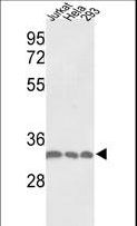 PCNA Antibody - Western blot of PCNA Antibody in Jurkat, HeLa, 293 cell line lysates (35 ug/lane). PCNA (arrow) was detected using the purified antibody.