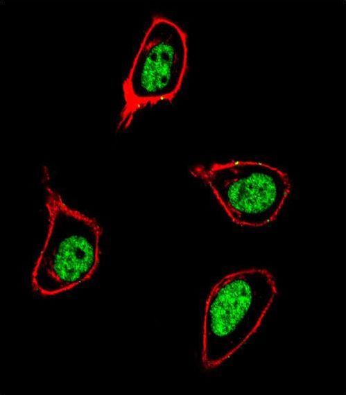 PCNA Antibody - Confocal immunofluorescence of PCNA Antibody with 293 cell followed by Alexa Fluor 488-conjugated goat anti-rabbit lgG (green). Actin filaments have been labeled with Alexa Fluor 555 phalloidin (red). DAPI was used to stain the cell nuclear (blue).