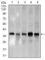 PCNA Antibody - Western blot using PCNA mouse monoclonal antibody against A431 (1), HeLa (2), HepG2 (3), Raji (4), and MOLT4 (5) cell lysate.