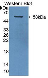 PCNA Antibody - Western blot of PCNA antibody.