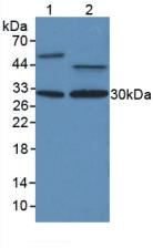 PCNA Antibody - Western Blot; Sample: Lane1: Human Liver Tissue; Lane2: Human MCF7 Cells.