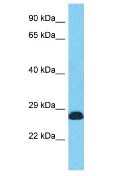 PCNA Antibody - PCNA / Cyclin antibody Western Blot of Fetal Heart. Antibody dilution: 1 ug/ml.  This image was taken for the unconjugated form of this product. Other forms have not been tested.