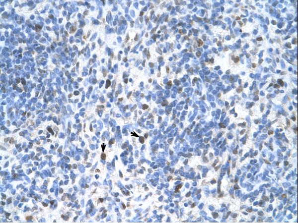 PCNA Antibody - PCNA antibody AVARP03018_T100-NP_002583-PCNA(proliferating cell nuclear antigen) Antibody was used in IHC to stain formalin-fixed, paraffin-embedded human spleen.  This image was taken for the unconjugated form of this product. Other forms have not been tested.