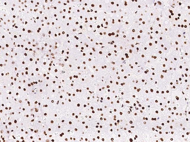 PCNA Antibody - Immunochemical staining of human PCNA in human liver with rabbit monoclonal antibody at 1:200 dilution, formalin-fixed paraffin embedded sections.