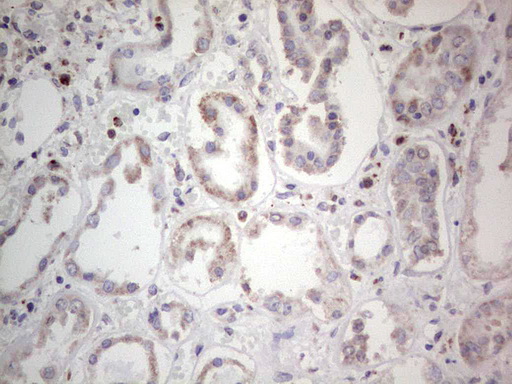 PCNA Antibody - IHC of paraffin-embedded Human Kidney tissue using anti-PCNA mouse monoclonal antibody. (Heat-induced epitope retrieval by 1 mM EDTA in 10mM Tris, pH8.5, 120°C for 3min).