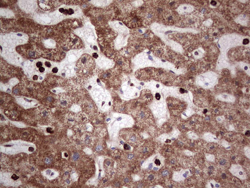 PCNA Antibody - IHC of paraffin-embedded Human liver tissue using anti-PCNA mouse monoclonal antibody. (Heat-induced epitope retrieval by 1 mM EDTA in 10mM Tris, pH8.5, 120°C for 3min).