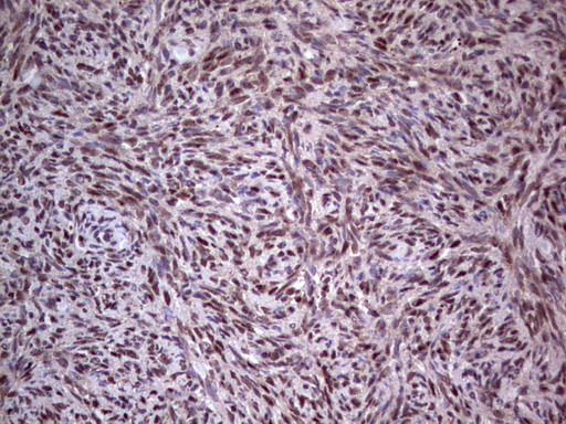 PCNA Antibody - IHC of paraffin-embedded Human Ovary tissue using anti-PCNA mouse monoclonal antibody. (Heat-induced epitope retrieval by 1 mM EDTA in 10mM Tris, pH8.5, 120°C for 3min).
