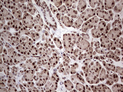 PCNA Antibody - IHC of paraffin-embedded Human pancreas tissue using anti-PCNA mouse monoclonal antibody. (Heat-induced epitope retrieval by 1 mM EDTA in 10mM Tris, pH8.5, 120°C for 3min).