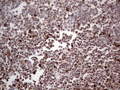 PCNA Antibody - IHC of paraffin-embedded Human tonsil using anti-PCNA mouse monoclonal antibody. (Heat-induced epitope retrieval by 1 mM EDTA in 10mM Tris, pH8.5, 120°C for 3min).