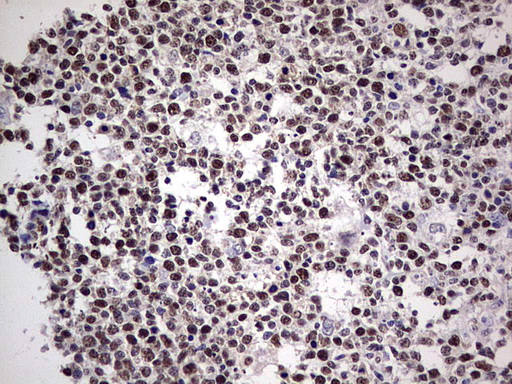 PCNA Antibody - IHC of paraffin-embedded Human tonsil using anti-PCNA mouse monoclonal antibody. (Heat-induced epitope retrieval by 1 mM EDTA in 10mM Tris, pH8.5, 120°C for 3min).
