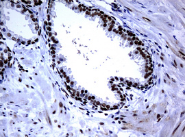 PCNA Antibody - IHC of paraffin-embedded Human prostate tissue using anti-PCNA mouse monoclonal antibody. (Heat-induced epitope retrieval by 10mM citric buffer, pH6.0, 120°C for 3min).