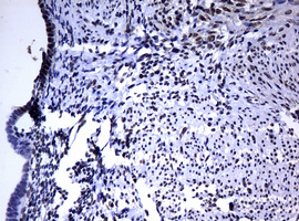 PCNA Antibody - IHC of paraffin-embedded Human endometrium tissue using anti-PCNA mouse monoclonal antibody. (Heat-induced epitope retrieval by 10mM citric buffer, pH6.0, 120°C for 3min).