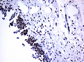 PCNA Antibody - IHC of paraffin-embedded Human bladder tissue using anti-PCNA mouse monoclonal antibody. (Heat-induced epitope retrieval by 10mM citric buffer, pH6.0, 120°C for 3min).