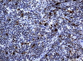 PCNA Antibody - IHC of paraffin-embedded Human lymph node tissue using anti-PCNA mouse monoclonal antibody. (Heat-induced epitope retrieval by 10mM citric buffer, pH6.0, 120°C for 3min).