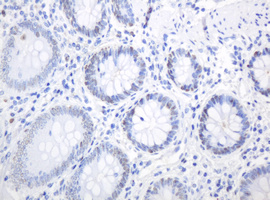 PCNA Antibody - IHC of paraffin-embedded Human colon tissue using anti-PCNA mouse monoclonal antibody.