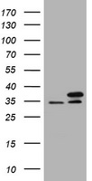 PCNA Antibody - HEK293T cells were transfected with the pCMV6-ENTRY control (Left lane) or pCMV6-ENTRY PCNA (Right lane) cDNA for 48 hrs and lysed. Equivalent amounts of cell lysates (5 ug per lane) were separated by SDS-PAGE and immunoblotted with anti-PCNA.