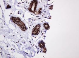 PCNA Antibody - IHC of paraffin-embedded Human breast tissue using anti-PCNA mouse monoclonal antibody.