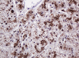 PCNA Antibody - IHC of paraffin-embedded Human liver tissue using anti-PCNA mouse monoclonal antibody.