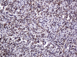 PCNA Antibody - IHC of paraffin-embedded Human Ovary tissue using anti-PCNA mouse monoclonal antibody.