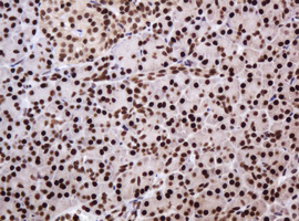PCNA Antibody - IHC of paraffin-embedded Human pancreas tissue using anti-PCNA mouse monoclonal antibody.