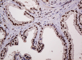 PCNA Antibody - IHC of paraffin-embedded Human prostate tissue using anti-PCNA mouse monoclonal antibody.