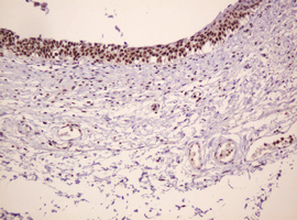PCNA Antibody - IHC of paraffin-embedded Human bladder tissue using anti-PCNA mouse monoclonal antibody.