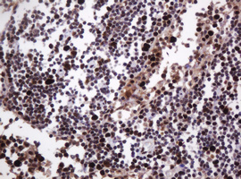 PCNA Antibody - IHC of paraffin-embedded Human lymph node tissue using anti-PCNA mouse monoclonal antibody.