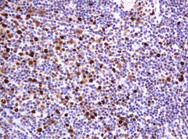 PCNA Antibody - IHC of paraffin-embedded Human tonsil using anti-PCNA mouse monoclonal antibody.