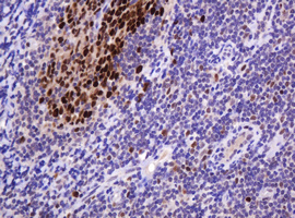 PCNA Antibody - IHC of paraffin-embedded Human tonsil using anti-PCNA mouse monoclonal antibody. (Heat-induced epitope retrieval by 10mM citric buffer, pH6.0, 120°C for 3min).