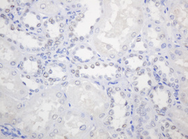 PCNA Antibody - IHC of paraffin-embedded Human Kidney tissue using anti-PCNA mouse monoclonal antibody. (Heat-induced epitope retrieval by 10mM citric buffer, pH6.0, 120°C for 3min).