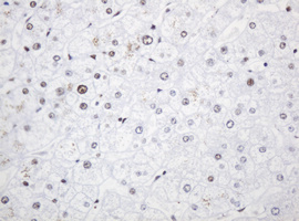 PCNA Antibody - IHC of paraffin-embedded Human liver tissue using anti-PCNA mouse monoclonal antibody. (Heat-induced epitope retrieval by 10mM citric buffer, pH6.0, 120°C for 3min).