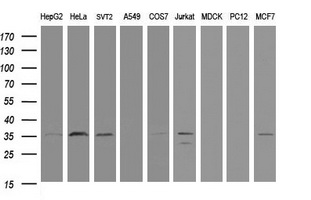 PCNA Antibody - Western blot of extracts (35 ug) from 9 different cell lines by using anti-PCNA monoclonal antibody (HepG2: human; HeLa: human; SVT2: mouse; A549: human; COS7: monkey; Jurkat: human; MDCK: canine; PC12: rat; MCF7: human).