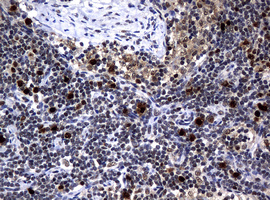 PCNA Antibody - IHC of paraffin-embedded Human lymph node tissue using anti-PCNA mouse monoclonal antibody.
