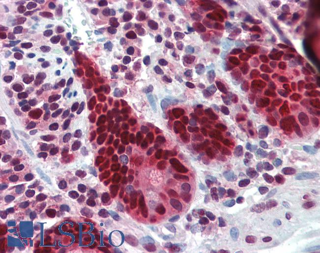 PCNA Antibody - Anti-PCNA antibody IHC of human small intestine. Immunohistochemistry of formalin-fixed, paraffin-embedded tissue after heat-induced antigen retrieval. Antibody concentration 10 ug/ml.  This image was taken for the unconjugated form of this product. Other forms have not been tested.