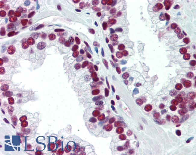 PCNA Antibody - Anti-PCNA antibody IHC of human prostate. Immunohistochemistry of formalin-fixed, paraffin-embedded tissue after heat-induced antigen retrieval. Antibody concentration 10 ug/ml.  This image was taken for the unconjugated form of this product. Other forms have not been tested.