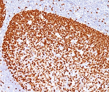 PCNA Antibody - PCNA antibody PC10 immunohistochemistry tonsil This image was taken for the unmodified form of this product. Other forms have not been tested.