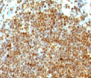 PCNA Antibody - Formalin-fixed, paraffin-embedded human tonsil stained with PCNA antibody (PM441-1).  This image was taken for the unmodified form of this product. Other forms have not been tested.
