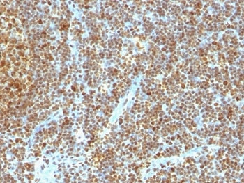 PCNA Antibody - Formalin-fixed, paraffin-embedded human tonsil stained with anti-PCNA antibody (SPM350).  This image was taken for the unmodified form of this product. Other forms have not been tested.
