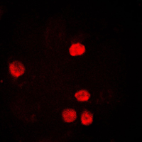 PCNA Antibody - Immunofluorescent analysis of PCNA staining in HeLa cells. Formalin-fixed cells were permeabilized with 0.1% Triton X-100 in TBS for 5-10 minutes and blocked with 3% BSA-PBS for 30 minutes at room temperature. Cells were probed with the primary antibody in 3% BSA-PBS and incubated overnight at 4 C in a humidified chamber. Cells were washed with PBST and incubated with a DyLight 594-conjugated secondary antibody (red) in PBS at room temperature in the dark. DAPI was used to stain the cell nuclei (blue).