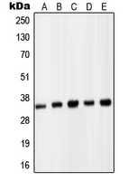 PCNA Antibody - Western blot analysis of PCNA expression in HeLa (A); HL60 (B); A431 (C); NIH3T3 (D); PC12 (E) whole cell lysates.