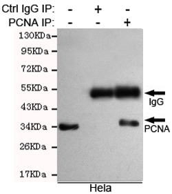 PCNA Antibody - Immunoprecipitation analysis of HeLa cell lysates using PCNA mouse monoclonal antibody.