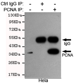 PCNA Antibody - Immunoprecipitation analysis of HeLa cell lysates using PCNA mouse monoclonal antibody.